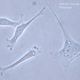 Fibroblastos